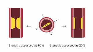 4 Primary and Secondary skin lesions [upl. by Wendel]