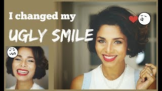 How to IMPROVE AWKWARD SMILE into PICTURE PERFECT Smile Without Dentist GIVEAWAY [upl. by Handel]