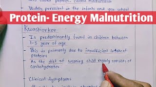 Protein  Energy Malnutrition  Kwashiorkor  Marasmus  Biochemistry [upl. by Southworth680]