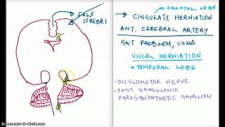 Easy Ways to Remember Cerebral Herniation [upl. by Tynan]