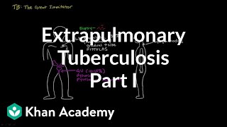 Tuberculosis  causes symptoms diagnosis treatment pathology [upl. by Zins]