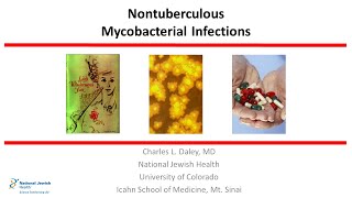 Nontuberculous Mycobacterial Infections 2019 [upl. by Nivri]