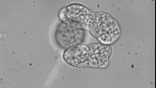 Entamoeba histolytica trophozoites [upl. by Anayek]