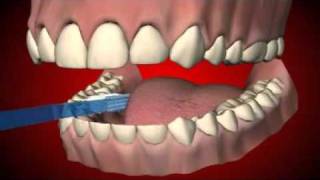 Smile Dental Care Tips [upl. by Norga924]