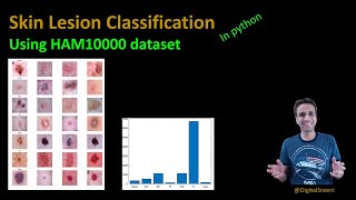 Cystic lesions of the pancreas  Dr Thompson Hopkins GIPATH [upl. by Namielus]