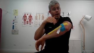 K Taping for Tennis Elbow [upl. by Nortyad]