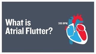 What is atrial flutter [upl. by Letney]