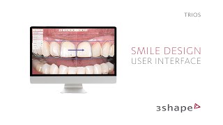 3Shape  Smile Design User Interface [upl. by Suzann]