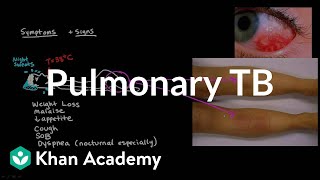 Extrapulmonary TB part 1  Infectious diseases  NCLEXRN  Khan Academy [upl. by Leirua132]