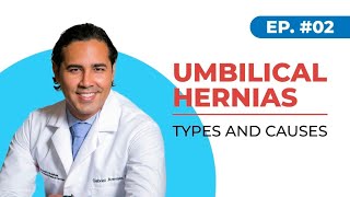 Umbilical Hernias Types and Causes Houston Texas [upl. by Marji]