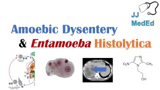 Amebiasis Amoebic Dysentery  Entamoeba histolytica Pathogenesis Signs amp Symptoms Treatment [upl. by Odnolor142]